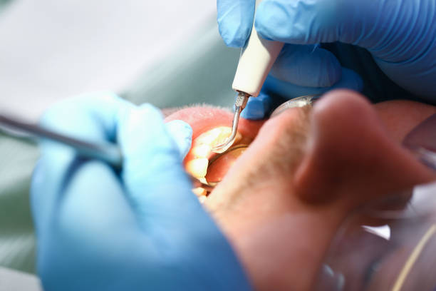 Best Emergency Dentist for Knocked-Out Tooth in Roscoe, IL
