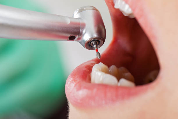 Best Mobile Emergency Dentist in Roscoe, IL